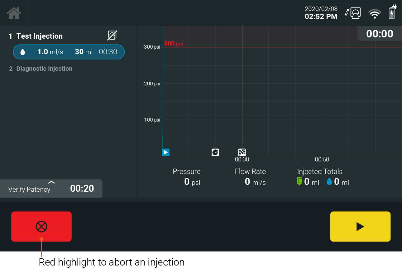 Example image of an abort button during an injection. Use red sparingly and according to relevant standards.