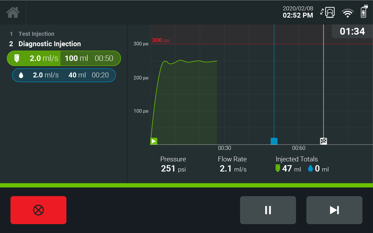 The use of simplified graph lines and minimal text creates a cleaner aesthetic for an animated pressure graph.