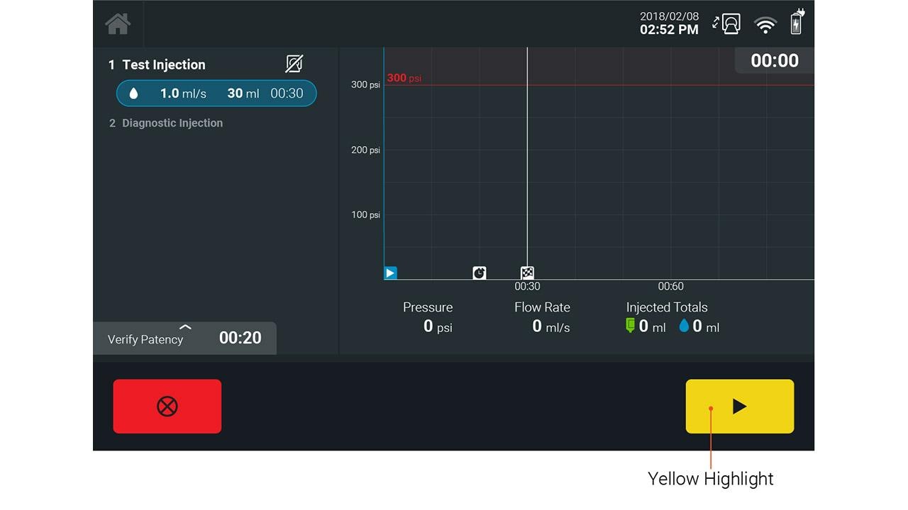 Critical task button is highlighted yellow.