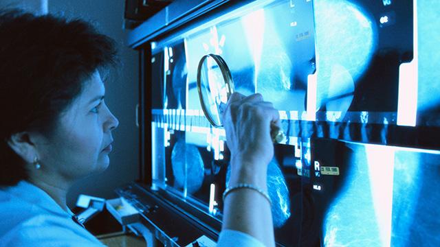 A person examines X-ray images on a lightbox using a magnifying glass.